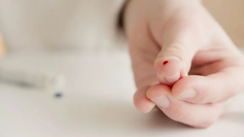Heimtest für Allergien: Fingerstich-Probe auf Trockenblut-Karte auftragen